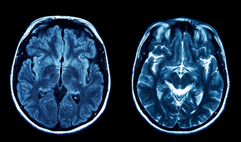 ASD Detection